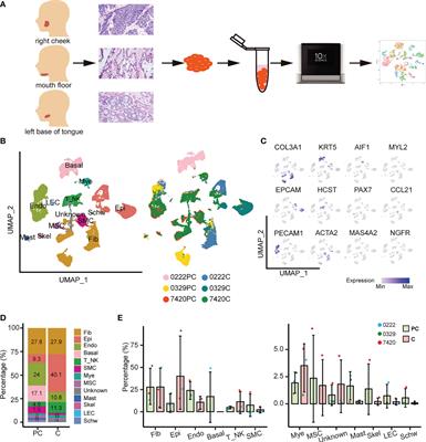 Single-cell transcriptomic analysis of the tumor ecosystem of adenoid cystic carcinoma
